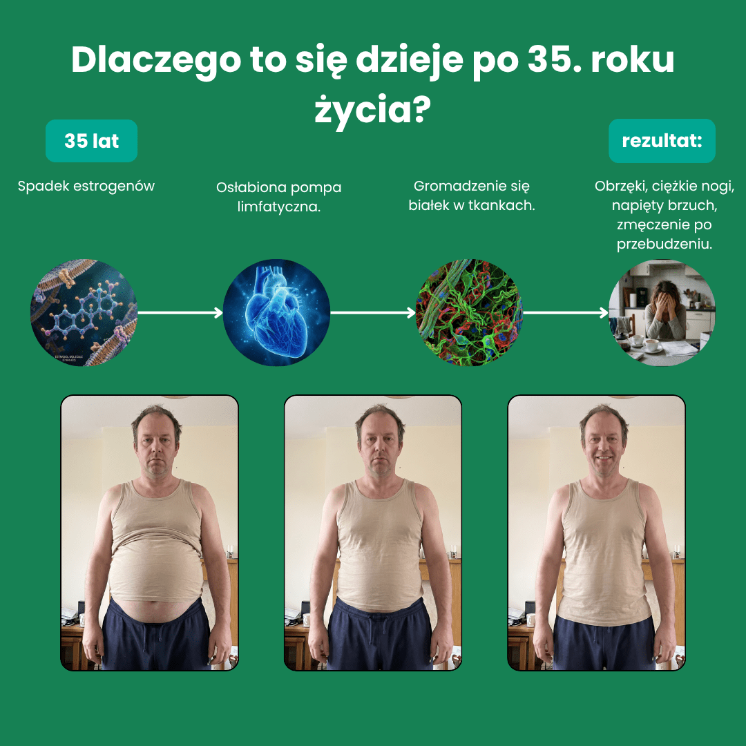 Drenaż Limfatyczny - MLP - Limfae